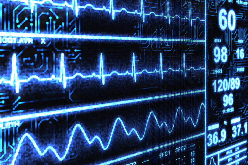 Regular monitoring of ICP is vital to diagnose serious brain conditions caused by elevated intracranial pressure.